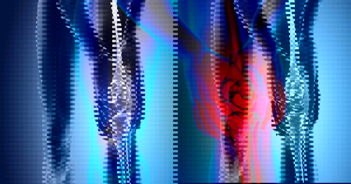 Diz Kireçlenmesi Ameliyatı