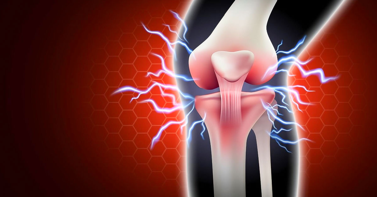 Diz Kireçlenmesi Ameliyatı
